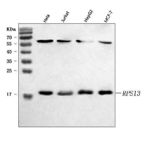 Anti-RPS13 Antibody Picoband® Boster Bio