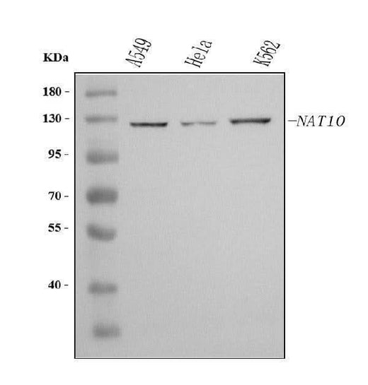 Anti-NAT10 Antibody Picoband® Boster Bio
