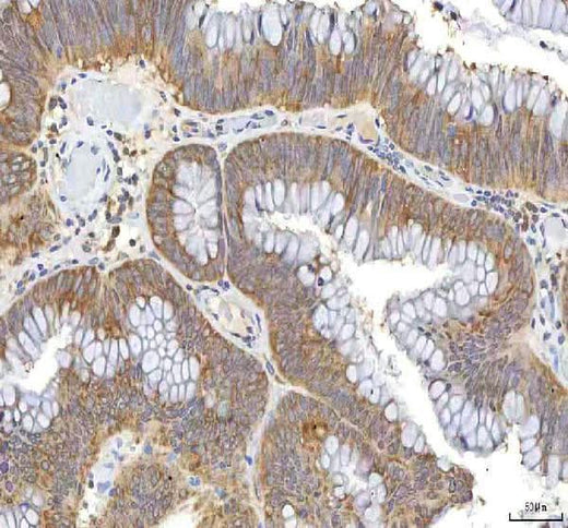 Anti-OCM Antibody Boster Bio