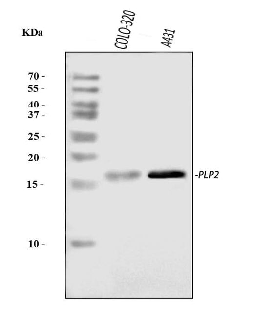 Anti-PLP2 Antibody Picoband® Boster Bio