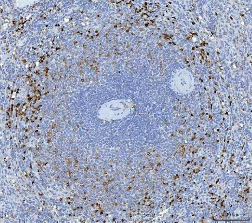 Anti-Granzyme K/GZMK Antibody Boster Bio