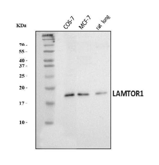 Anti-LAMTOR1 Antibody Picoband® Boster Bio