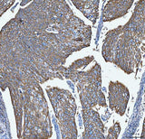Anti-S100A14 Antibody Boster Bio