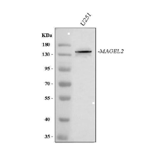 Anti-MAGEL2 Antibody Picoband® Boster Bio