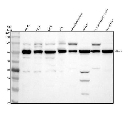 Anti-UBE3C Antibody Picoband® Boster Bio