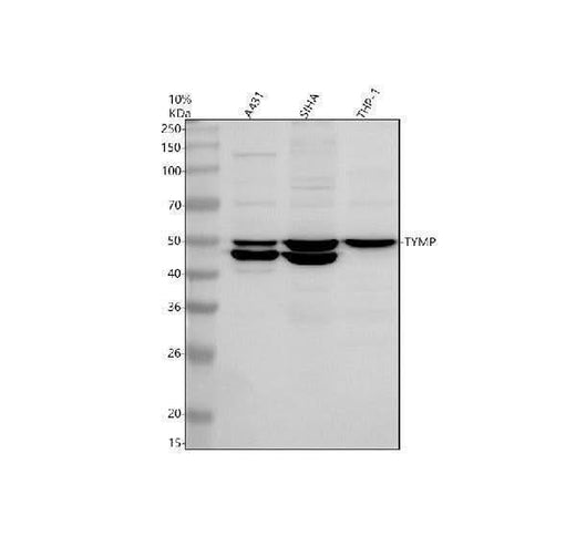 Anti-PD-ECGF/TYMP Antibody Picoband® Boster Bio