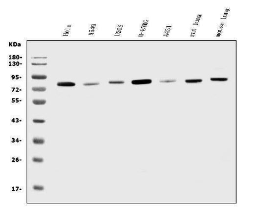 Anti-K Cadherin/CDH6 Antibody Picoband® Boster Bio