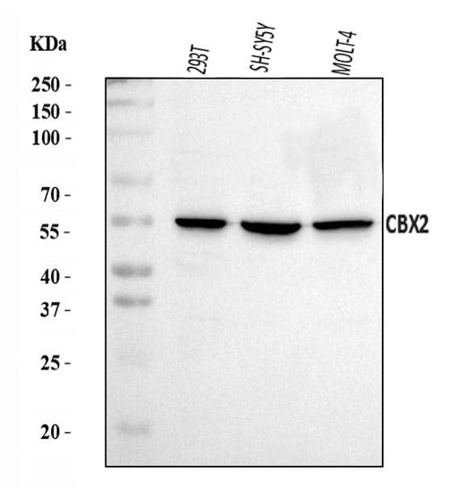 Anti-CBX2 Antibody Picoband® Boster Bio