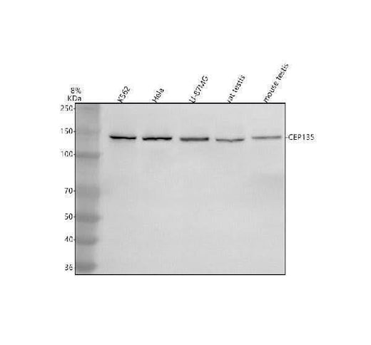 Anti-CEP135 Antibody Picoband® Boster Bio