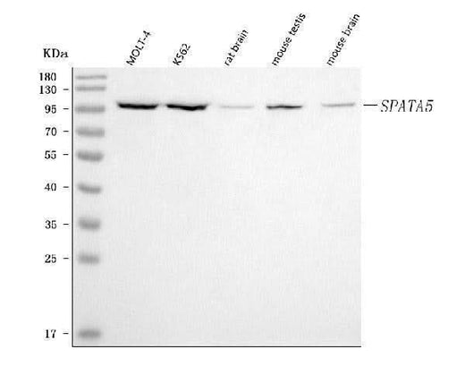 Anti-SPATA5 Antibody Picoband® Boster Bio