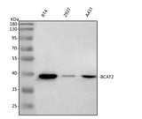 Anti-BCAT2 Antibody Picoband® Boster Bio