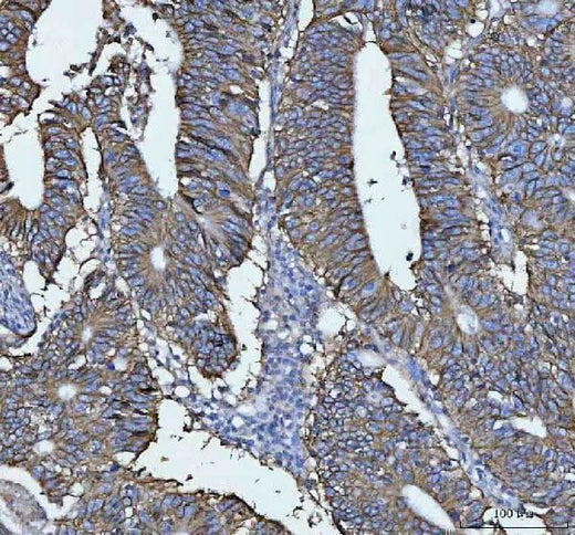Anti-LI Cadherin/CDH17 Antibody Boster Bio