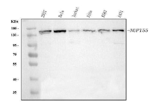Anti-NUP155 Antibody Picoband® Boster Bio