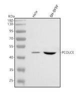 Anti-PCOLCE Antibody Picoband® Boster Bio
