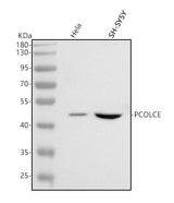 Anti-PCOLCE Antibody Picoband® Boster Bio