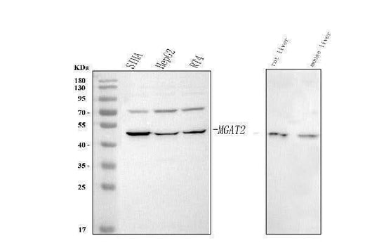 Anti-MGAT2 Antibody Picoband® Boster Bio