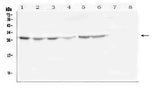 Anti-SCN4B Antibody Picoband® Boster Bio