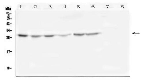 Anti-SCN4B Antibody Picoband® Boster Bio