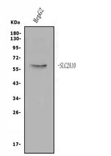 Anti-GLUT10/SLC2A10 Antibody Picoband® Boster Bio