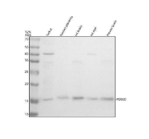 Anti-PDE6D Antibody Picoband® Boster Bio