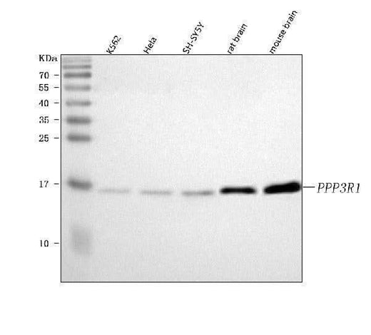 Anti-PPP3R1 Antibody Picoband® Boster Bio