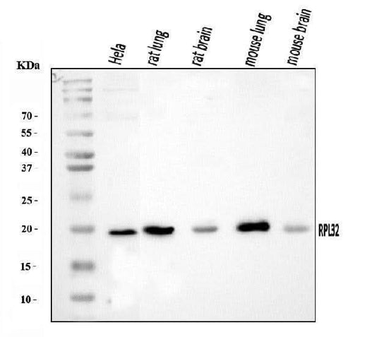 Anti-RPL32 Antibody Picoband® Boster Bio