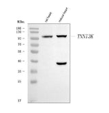 Anti-TNNI3K Antibody Picoband® Boster Bio