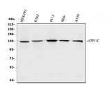 Anti-ATP11C Antibody Picoband® Boster Bio