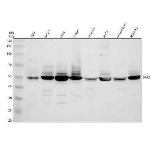 Anti-DARS1 Antibody Picoband® Boster Bio