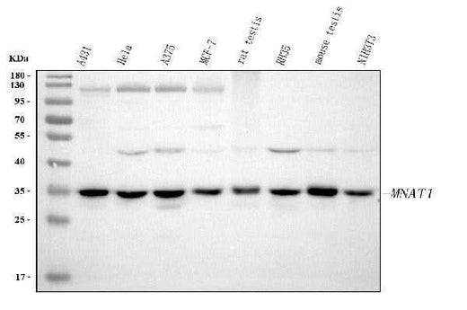 Anti-MNAT1 Antibody Picoband® Boster Bio