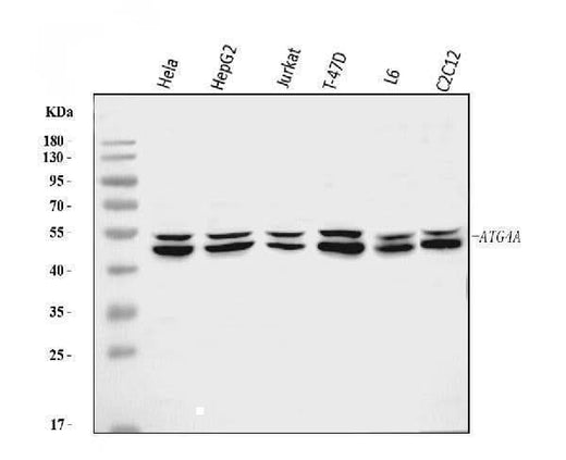Anti-ATG4A Antibody Picoband® Boster Bio