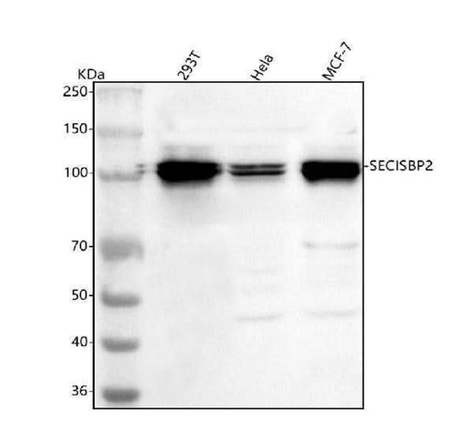 Anti-SECISBP2 Antibody Picoband® Boster Bio