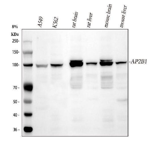 Anti-AP2B1 Antibody Picoband® Boster Bio