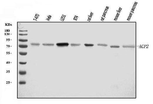 Anti-ACP2 Antibody Picoband® Boster Bio