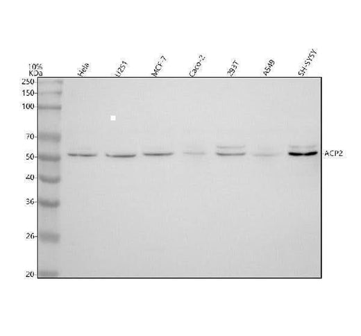 Anti-ACP2 Antibody Picoband® Boster Bio