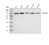 Anti-PSMD2 Antibody Picoband® Boster Bio