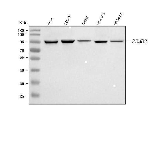Anti-PSMD2 Antibody Picoband® Boster Bio