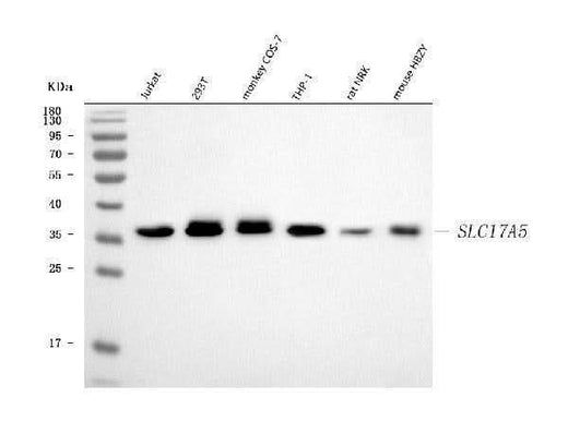 Anti-SLC17A5 Antibody Picoband® Boster Bio
