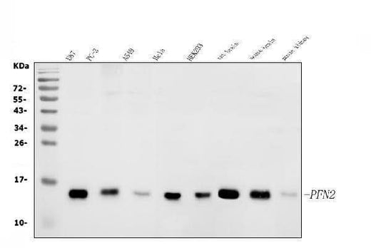 Anti-Profilin 2/PFN2 Antibody Picoband® Boster Bio