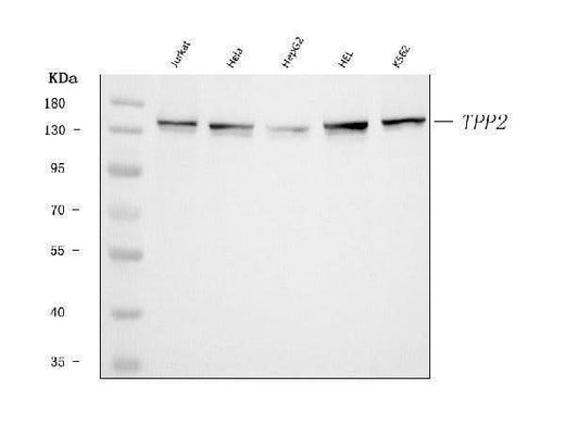 Anti-Tripeptidyl peptidase II/TPPII/TPP2 Antibody Picoband® Boster Bio