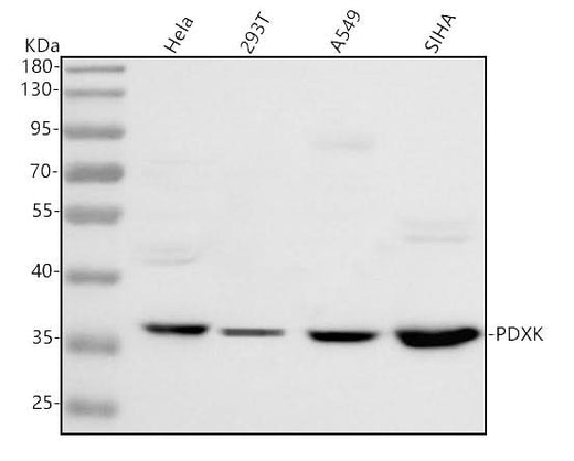 Anti-PDXK Antibody Picoband® Boster Bio