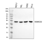 Anti-NSMCE2 Antibody Picoband® Boster Bio