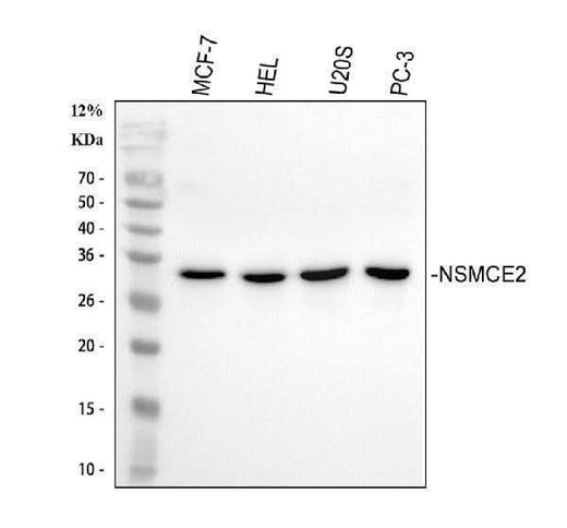 Anti-NSMCE2 Antibody Picoband® Boster Bio