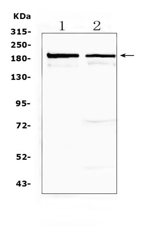 Anti-Neurocan/NCAN Antibody Picoband® Boster Bio