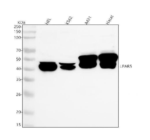 Anti-LPAR5 Antibody Picoband® Boster Bio