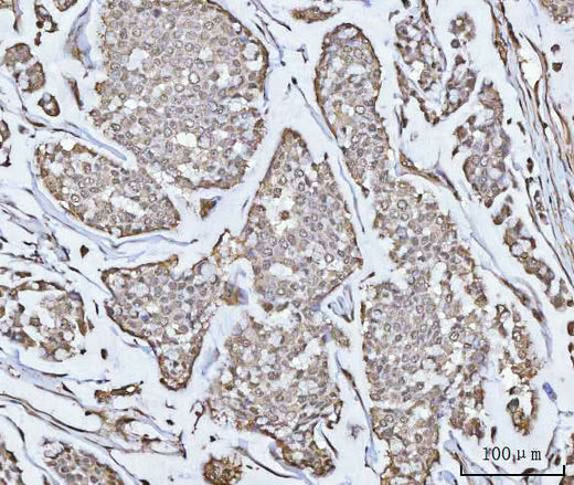 Anti-PPM1G Antibody Picoband® Boster Bio