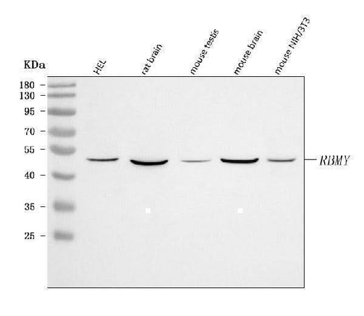 Anti-RBMY1A1 Antibody Picoband® Boster Bio