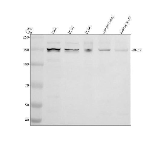 Anti-BNC2 Antibody Picoband® Boster Bio