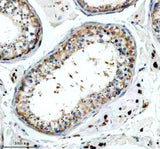 Anti-SLC15A4 Antibody Boster Bio