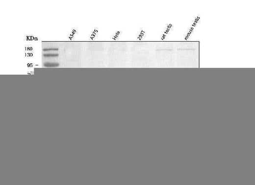 Anti-TOMM34 Antibody Picoband® Boster Bio